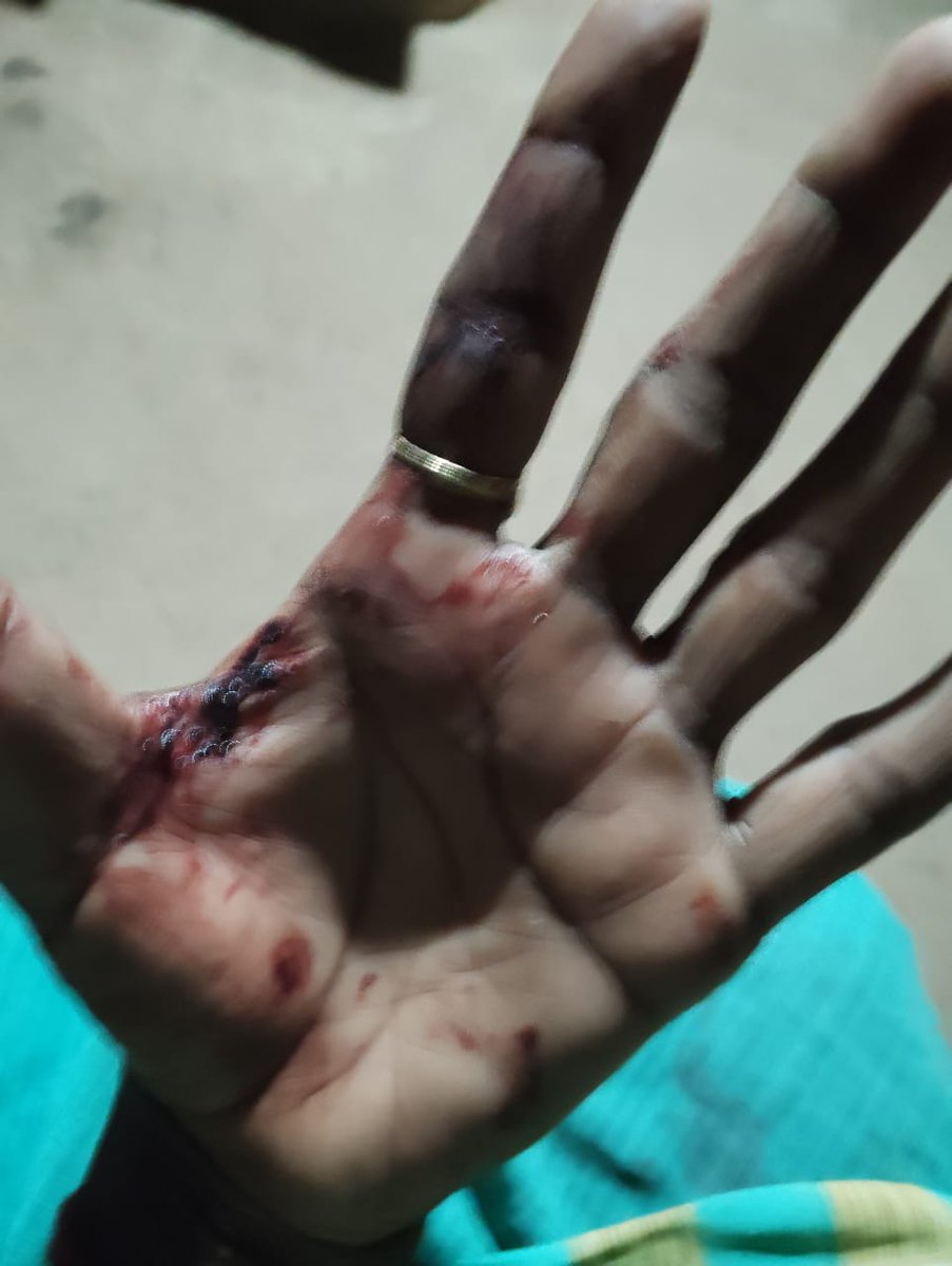 जनपद कौशाम्बी के सरांय अकिल थाने के अतर्गत आने वाले गांव नन्दा का पुरा के एक गरीब महिला और उसके बच्चे और सासू मां के साथ मर पीट कि जाती है पीड़ित महिला थाना का दो दिन से चक्कर लगा रही है अभी तक मुकदमा दर्ज  नही किया गया  
<a href="/Uppolice/">UP POLICE</a>  से पीड़ित महिला को न्याय कि उम्मीद है