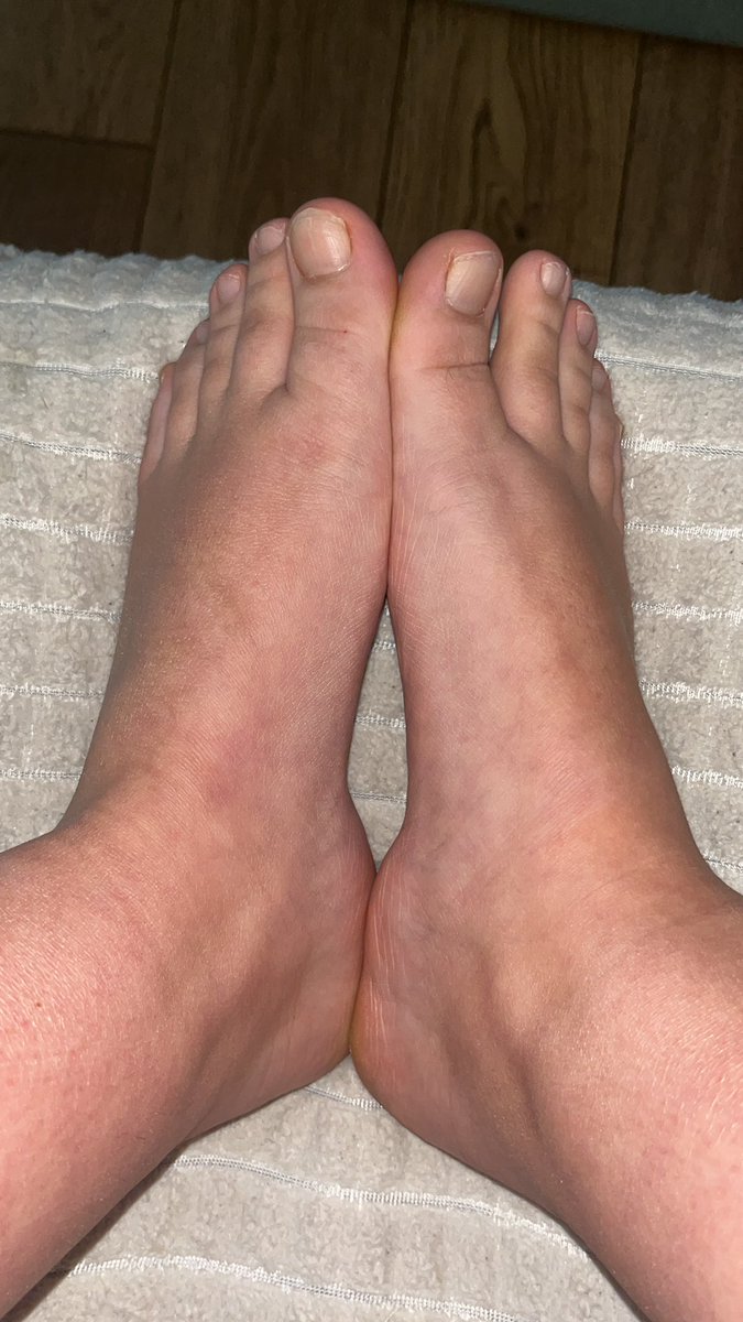 Pieds Potager tweet media