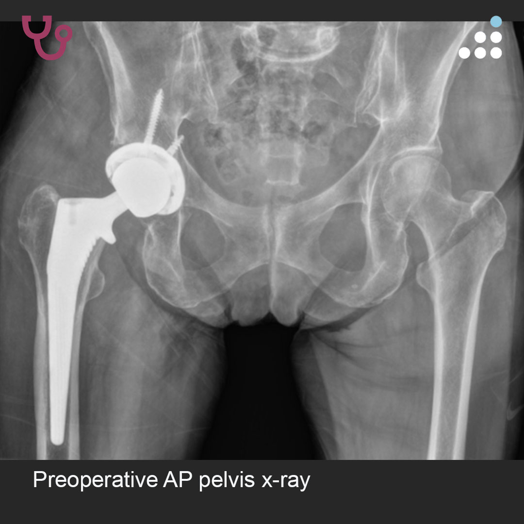 Orthobullets tweet media