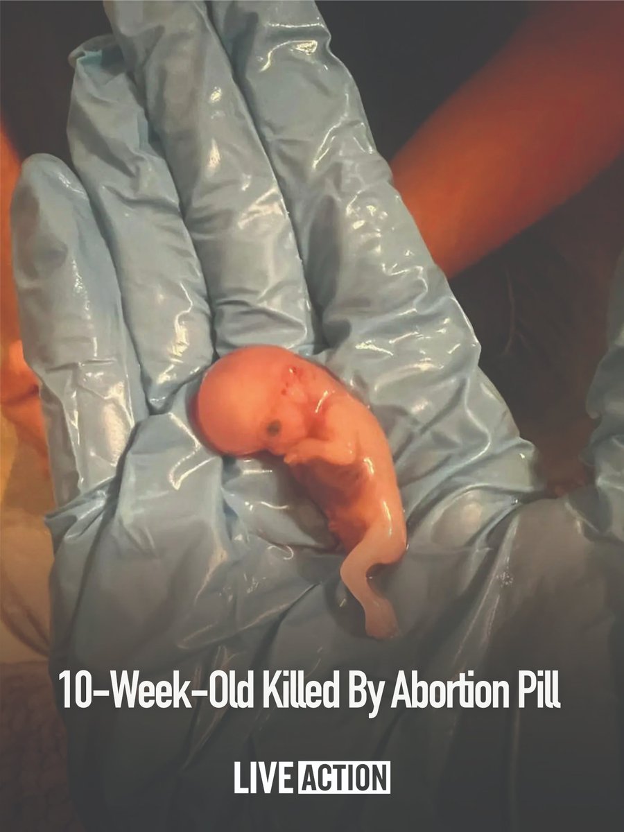 Live Action tweet media