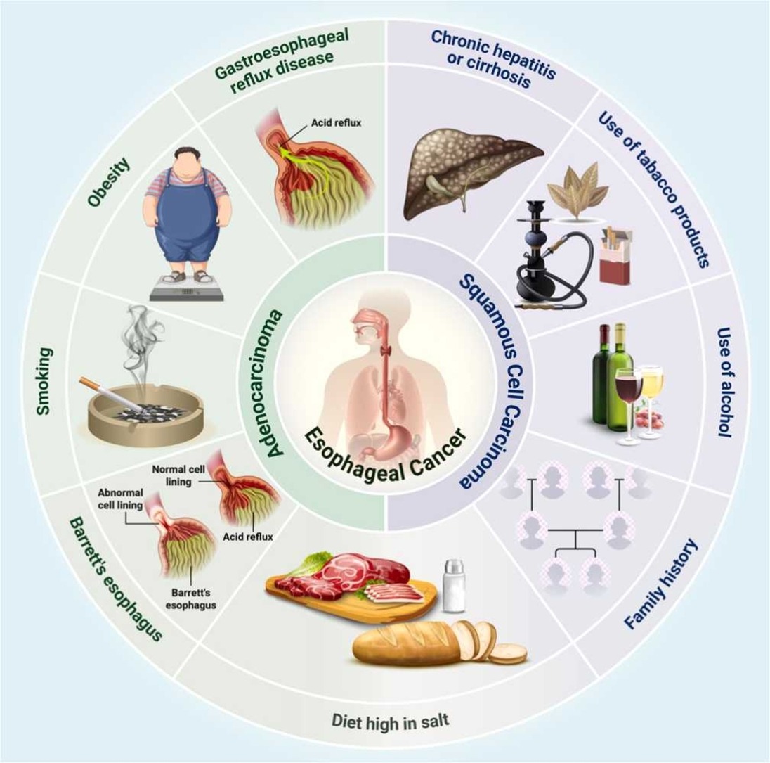 _MCRicardo_'s tweet image. Microbiota and esophageal cancer: From dysbiosis to carcinogenesis

Highlights

▶️ Microbiota dysbiosis is linked to the development of esophageal cancer.

▶️ ESCC shows increased Fusobacterium and reduced Streptococcus.

▶️ EAC tumors are enriched in lactic acid–producing