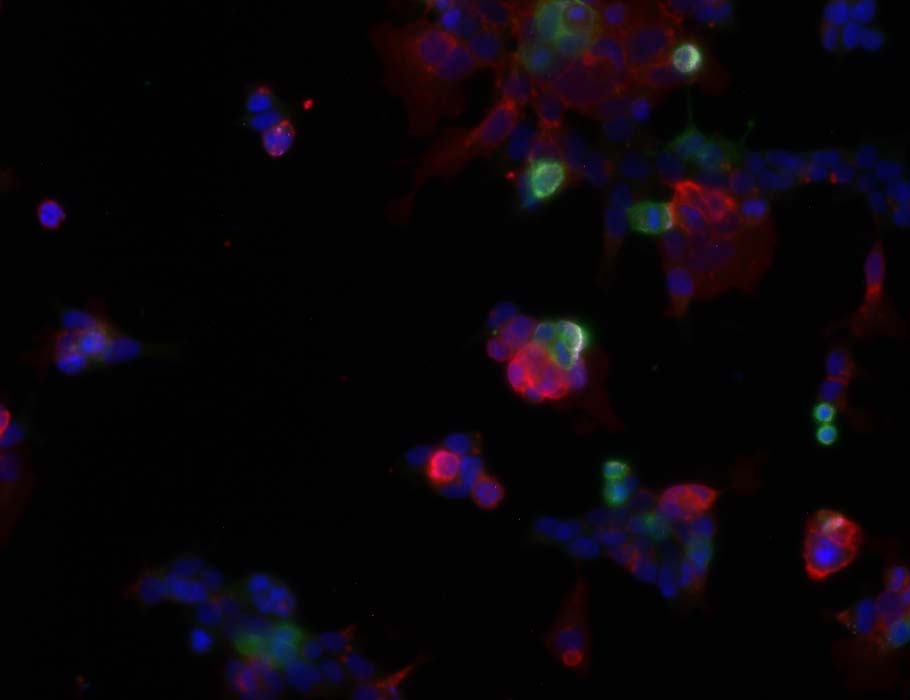 Science Immunology tweet media