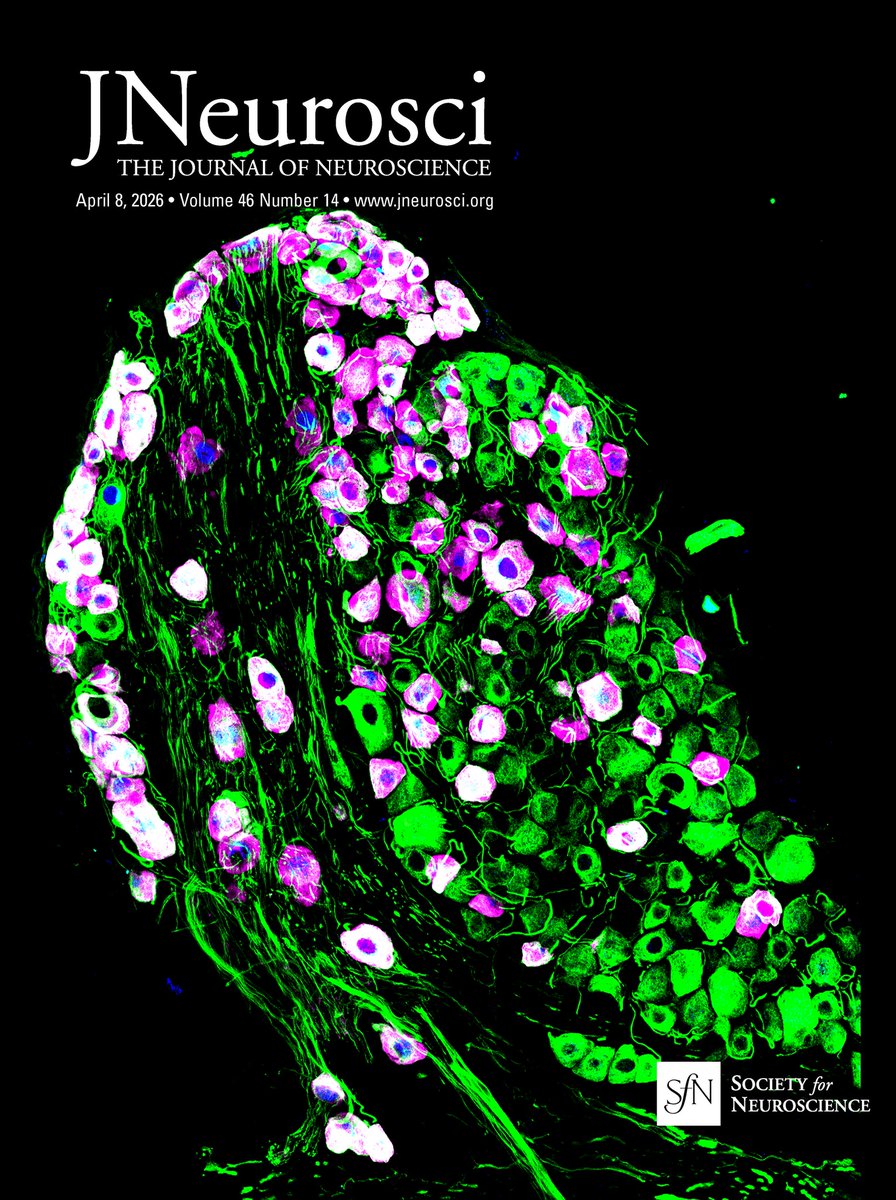 SfNJournals's tweet photo. This Week in The Journal #JNeurosci | How Visual Cortices Develop; Dopamine Dynamics during Decision-Making
https://t.co/iglk3cAF3j https://t.co/EX8WTq7G0x