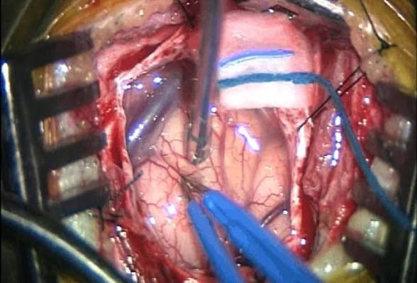 Ron Barbosa MD FACS tweet media