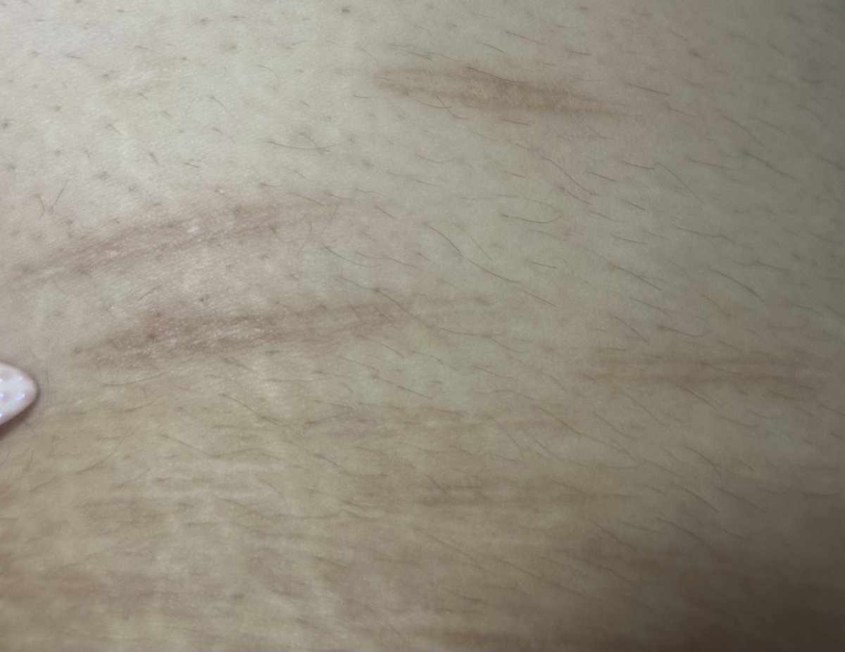 angie (4/25kg) tweet media