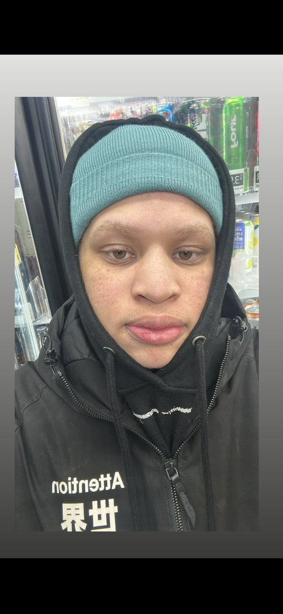 Jaquin Glo tweet media