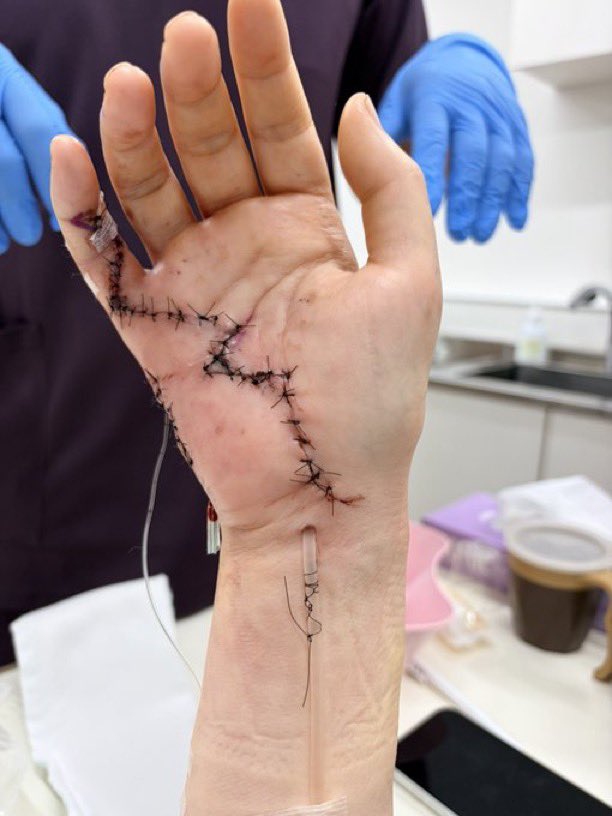 Local Street tweet media