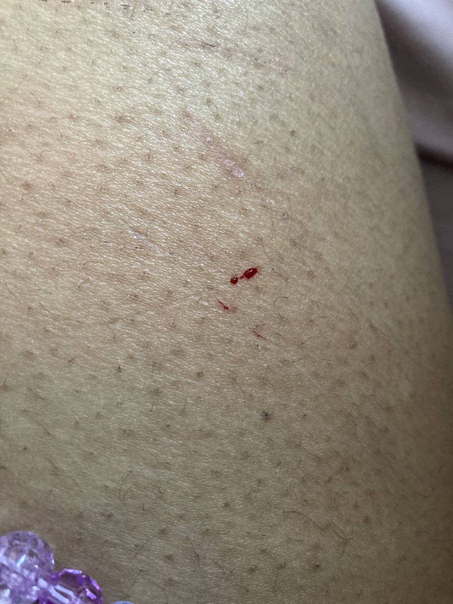 ◡◡ 。adri of shtwt .ᐟ.ᐟ ✦、 tweet media