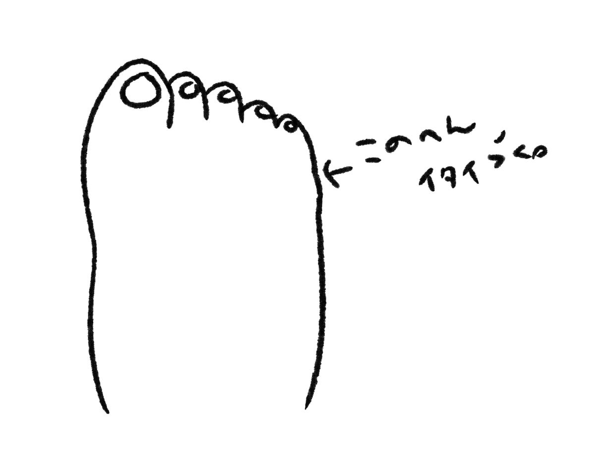 ここ、痛いんだけど、腫れてもないし青くなってるとかもないので、打ち身とかそういうやつかな 