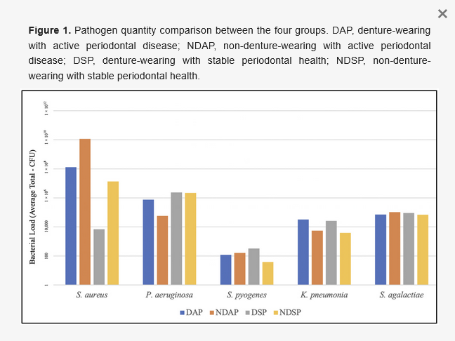 🦷New in Prosthesis: "Assessment of the Effect of Denture-Wearing and Periodontal Disease on the Microbial Load of Respiratory Pathogens "

by  Batiller et al.

🔓 #Open_Access, free to read at: 
brnw.ch/21x1Du9

#Prosthetics #RemovableDenture