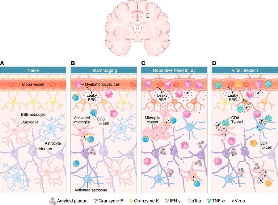 LukensJohnR's tweet photo. Immune signaling and function in neurodegeneration
https://t.co/NcEbUPvA5s https://t.co/5MaVndTzkO
