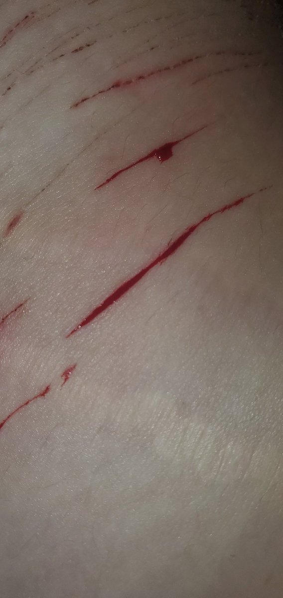 Lexi-licous ♡ shedtwt tweet media