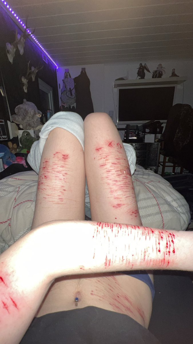 g0recake_rin's tweet photo. I barely have any space left sigh now i gott wait till its healed
#cut #shtwt #sh #slashflash #cutspo #slashed #cuttingboard #shedtwt #shed https://t.co/muFTOwu9Rq