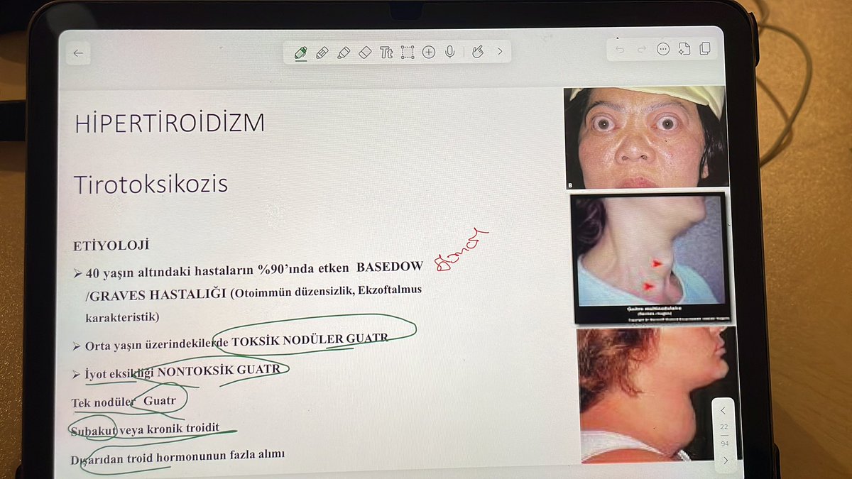 Şu saate okuduğum slaytın tatsızlık seviyesi