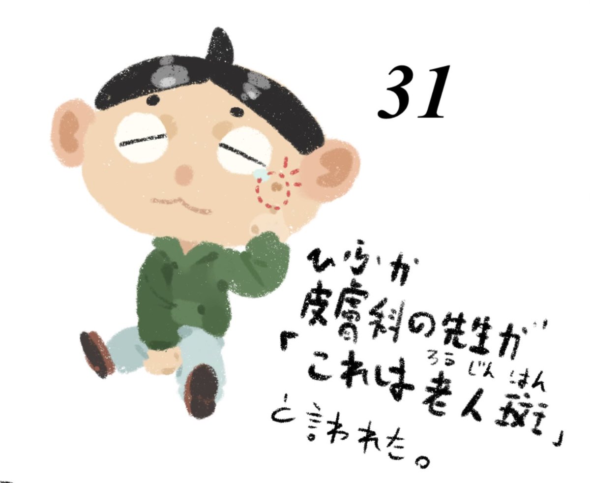 s0983012's tweet photo. 二十九歳の私、老人斑をもらえました。 https://t.co/1S05tqXFMl