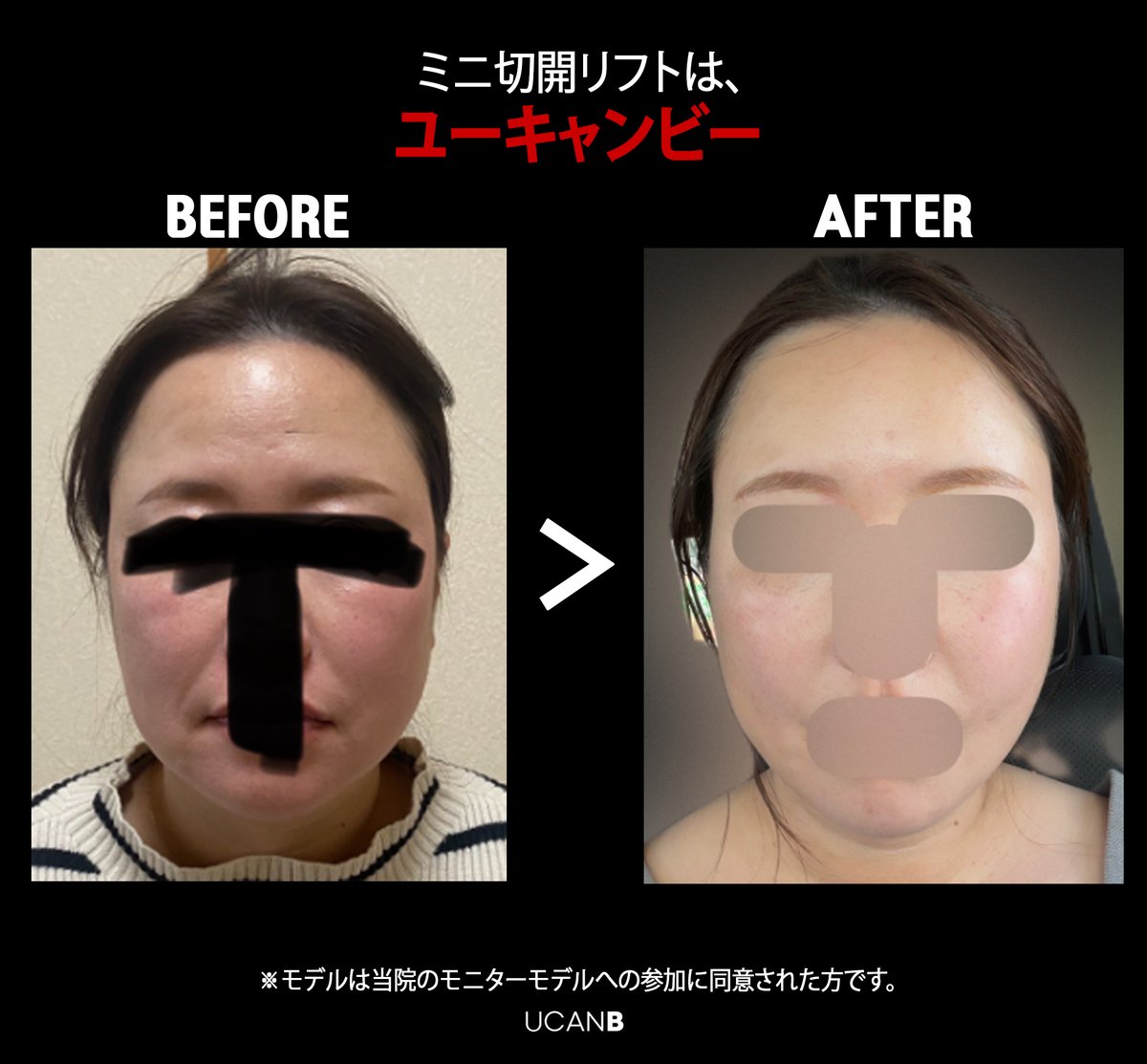 【公式】UcanB美容外科・皮膚科 tweet media