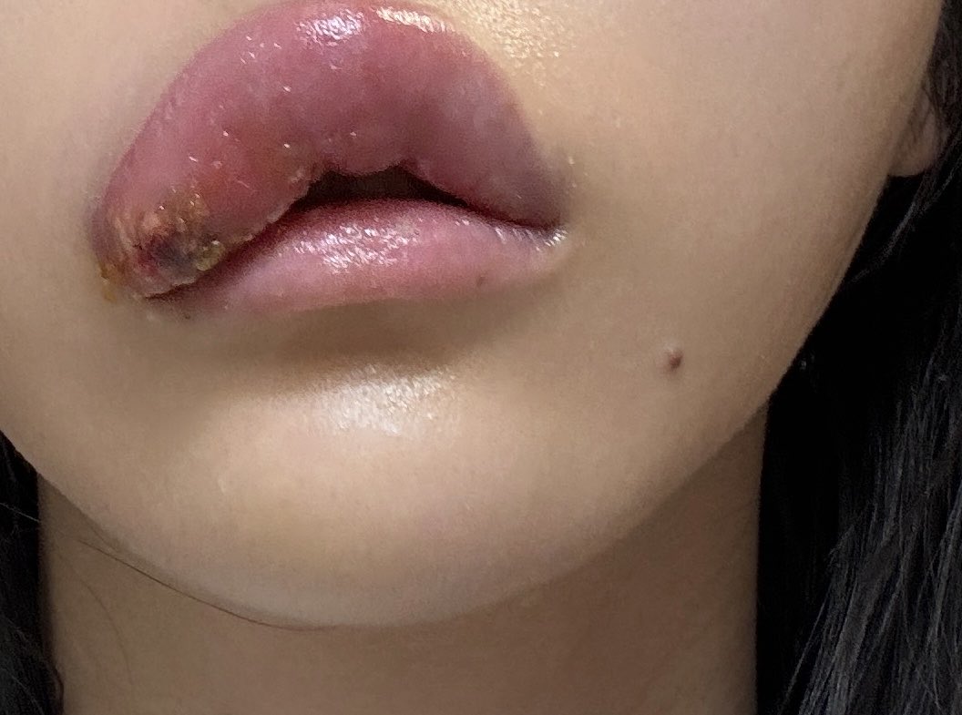 ぽたみう tweet media