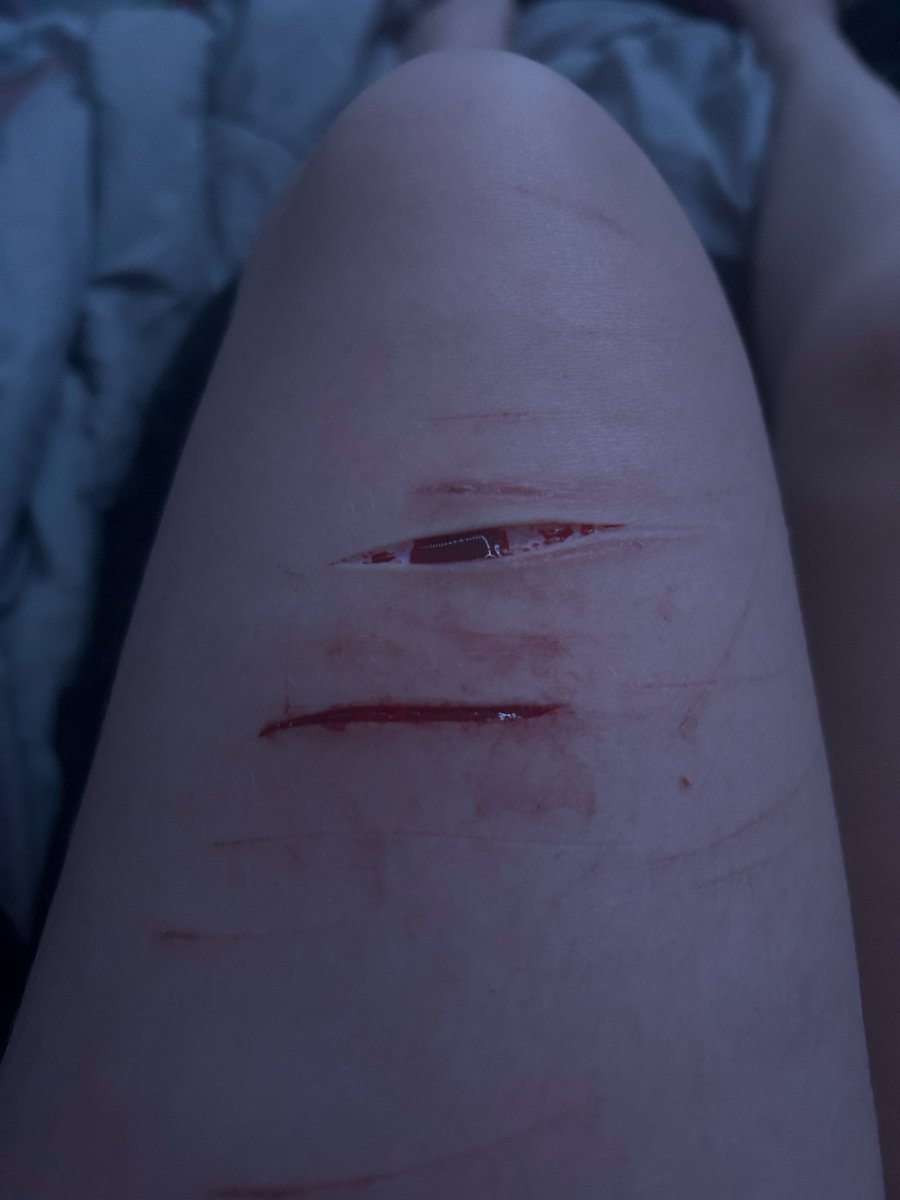 ⊹•∘˙˚✩ ɪᴠᴀɴ ✩˚˙∘•⊹ tweet media