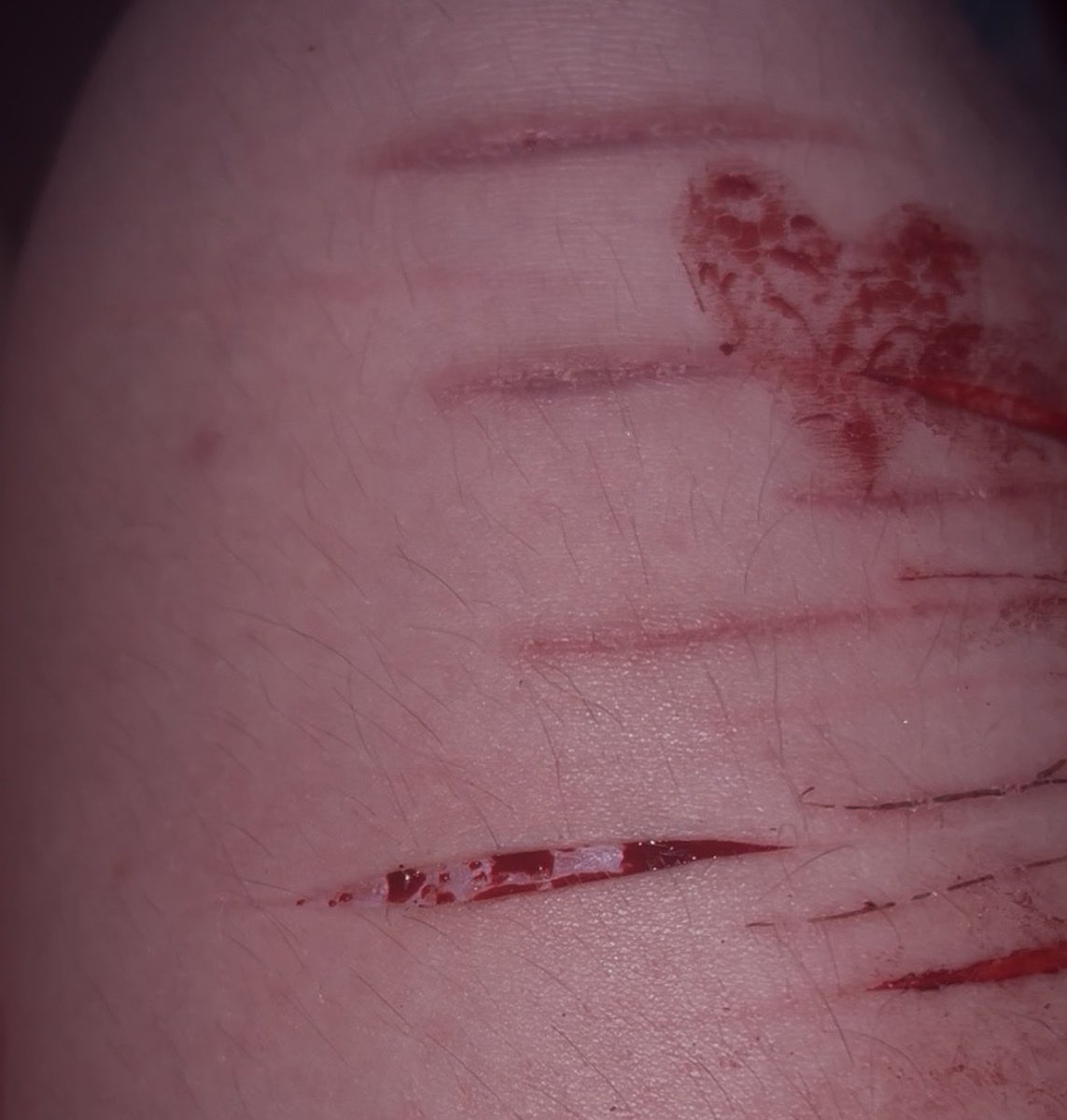 ⊹•∘˙˚✩ ɪᴠᴀɴ ✩˚˙∘•⊹ tweet media