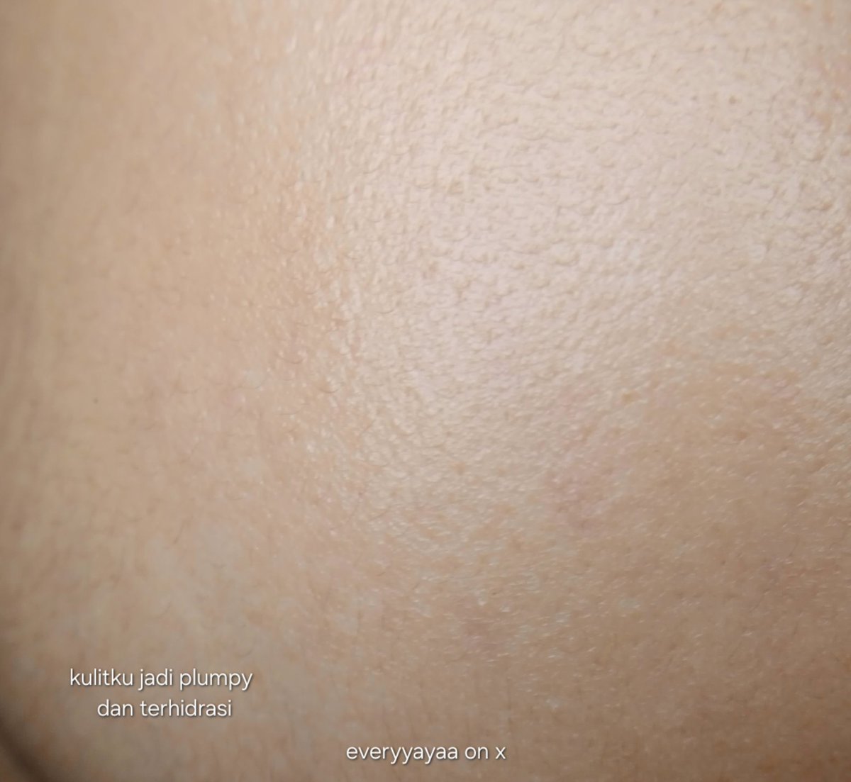 salah satu best purchase tahun ini adalah moisturizer dari local brand, yang bikin kulit aku much better. oke banget buat recovery kulit yang lagi rewel, bisa dijadiin alternatif pengganti retinol 🫶🏻