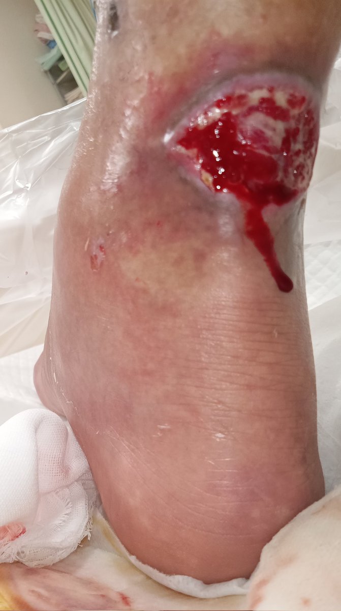 せんじゅ色男土方利権しか頭にない近藤やよい足立区長に天誅！ tweet media