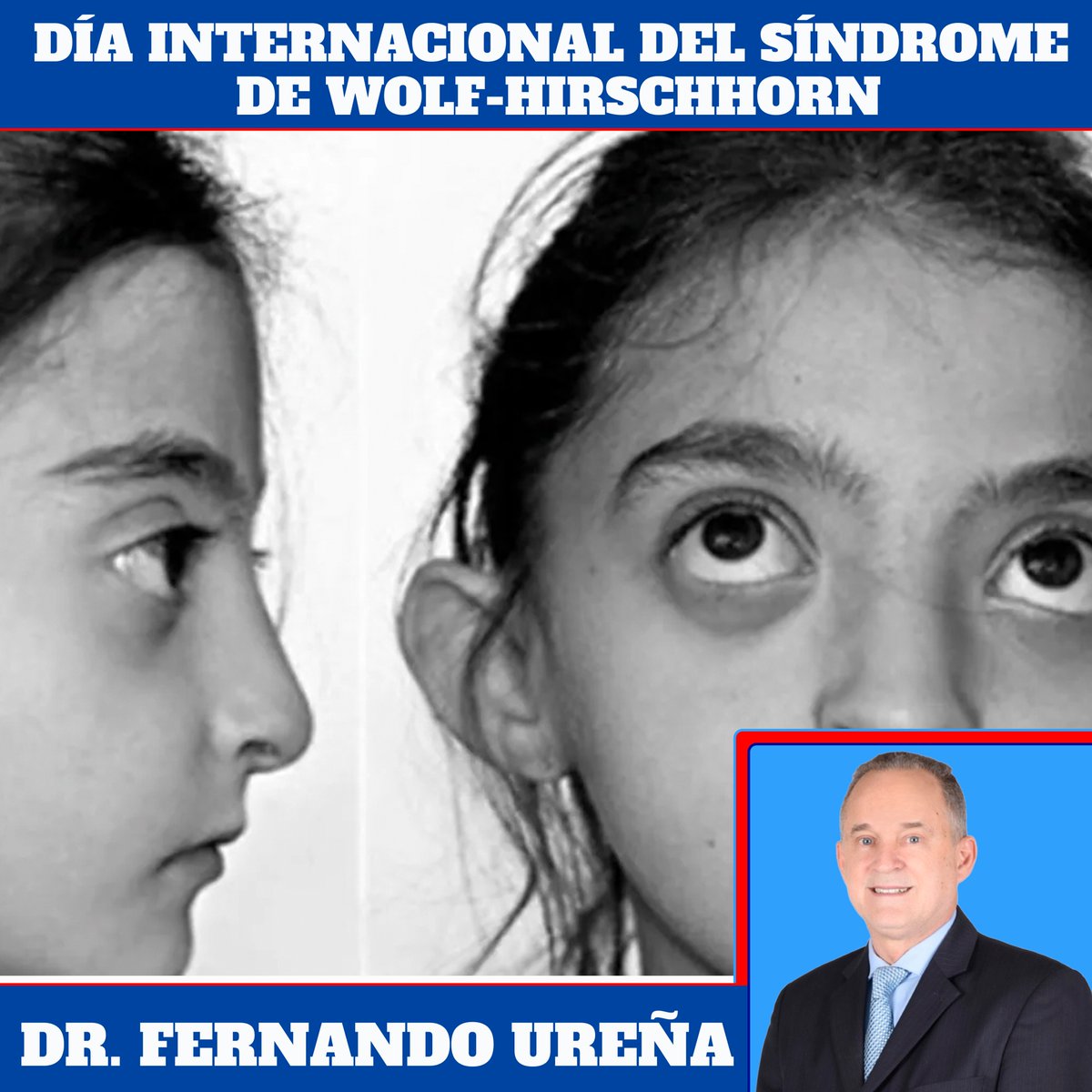 En el Día Internacional del Síndrome de Wolf-Hirschhorn, unimos nuestras voces para crear conciencia, promover la inclusión y brindar apoyo a quienes viven con esta condición y a sus familias. La empatía, la investigación y la solidaridad construyen esperanza. <a href="/luisabinader/">Luis Abinader</a>