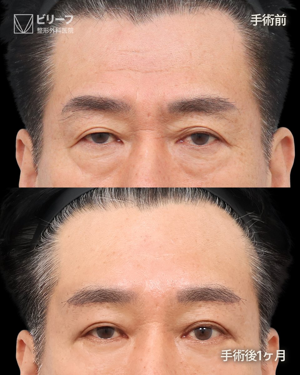 ✨韓国フェイスリフト専門ビリーフ美容外科✨ tweet media