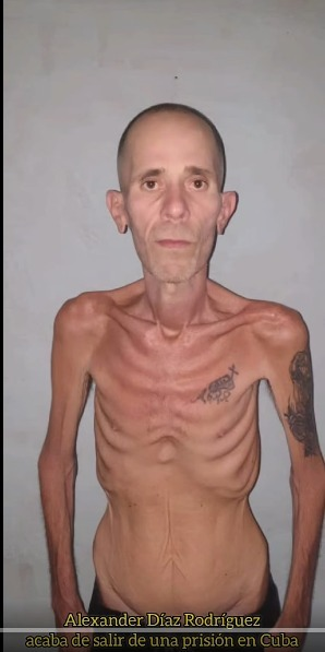 HerrLauter's tweet photo. Así luce el preso político cubano Alexander Díaz Rodríguez de 45 años tras su reciente liberación por el régimen castrista. Su estampa recuerda los horrores de los campos de concentración nazi. Esta es la utopía que la izquierda latinoamericana quiere para la región. https://t.co/b6wHnKJeUC
