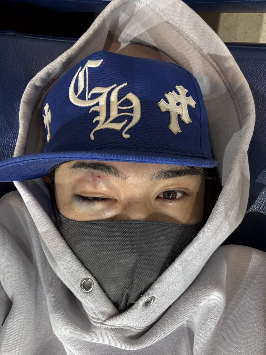 yuushi_akimoto6's tweet image. 試合前に眼下低骨折これも人生
5.4まじ出たかったな
#deep