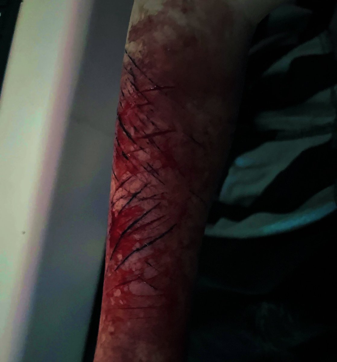 𓆩♱ badger .ᐟ ҂🩸 tweet media