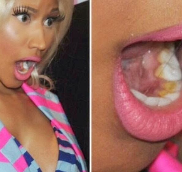 🍒ifb 🥹 tweet media