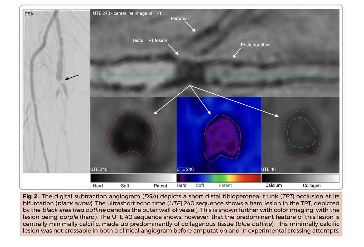 Trisha L. Roy MD PhD FACS tweet media