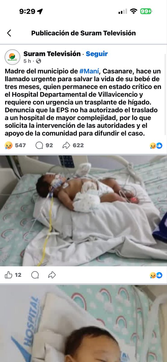 yasser_matus's tweet photo. Trasladarlo a bogota, por favor quien nos ayuda. Su pobre madre  está desesperada. 😞 está hospitalizado en el hospital departamental de Villavicencio, su nombre es YEHIKOL DAVID CASTILLO CRUZ  de tan solo 3 meses de edad. El cel de su madre es 3181854882. https://t.co/HLT5GryLeF