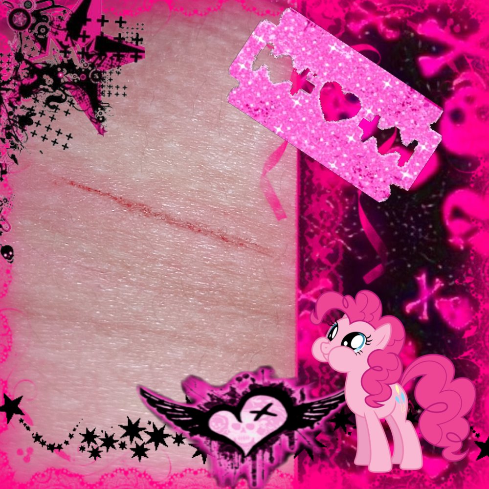 Alanx33333's tweet image. Took another pic hehe (๑˃̵ᴗ˂̵)و✧ #shtwt #slittwt #ouchietwt #suicidetwt #988twt