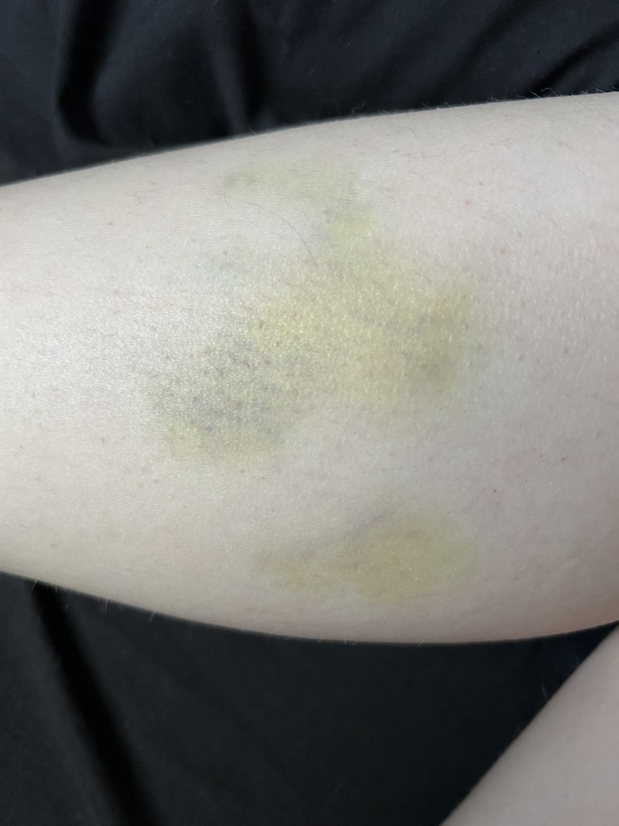 menheraxfreak's tweet image. "he hit me and it felt like a kiss" more like he BIT me and it felt like a BITE @food_4_neglect