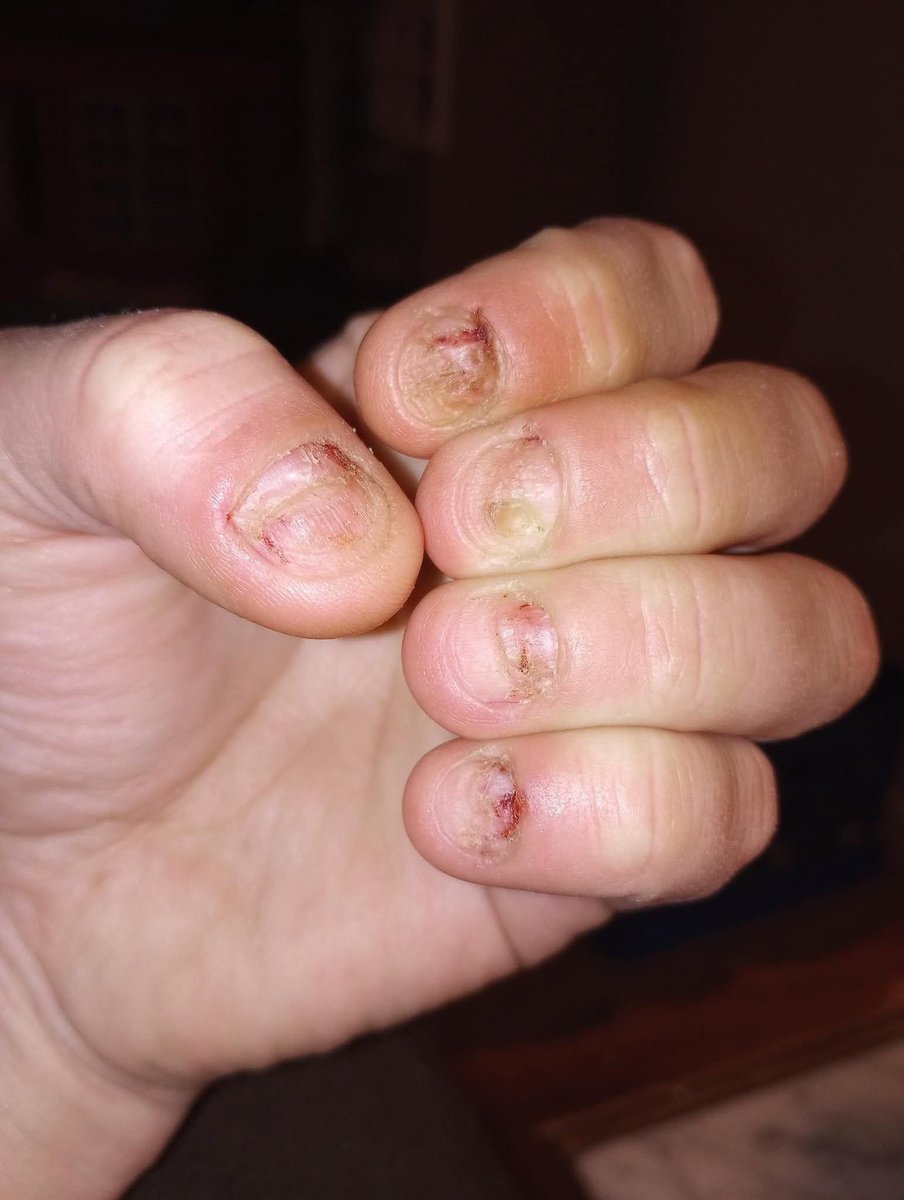 الانجليزية ببساطة tweet media