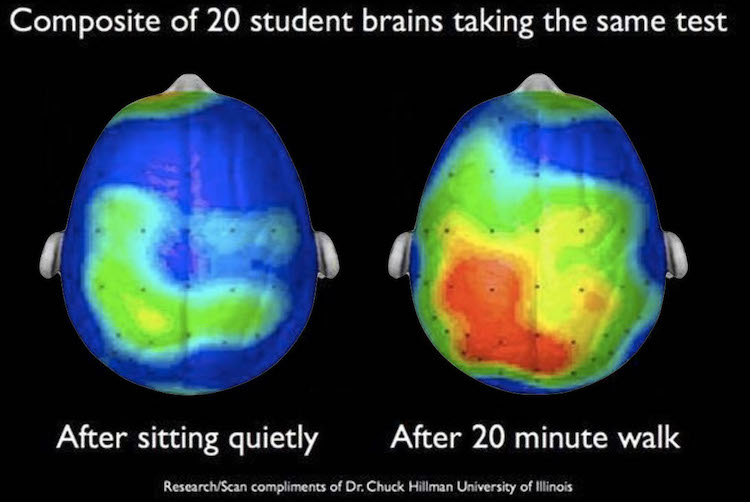 BowTiedTrance's tweet image. I love stuff like this.

Three easy things you can do every day for your brain health:

1. Drink water
2. Take a walk
3. Spend some time in daydream/trance state

All of that is free.