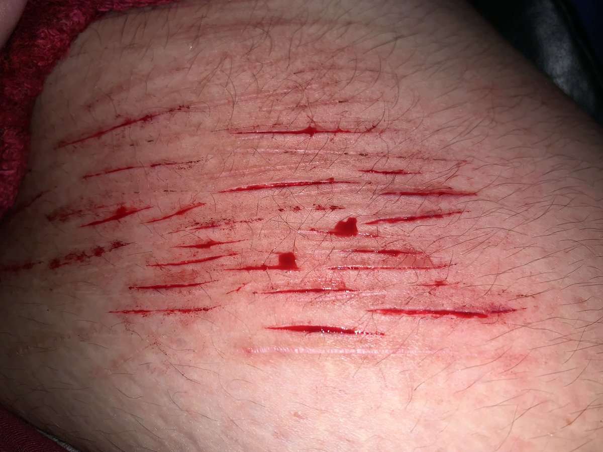 ꒰ 𝐚𝐦𝐚𝐣𝐢𝐤𝐢 𝐨𝐟 𝐬𝐡𝐭𝐰𝐭 ⸝⸝ ♡ྀི ꒱ tweet media