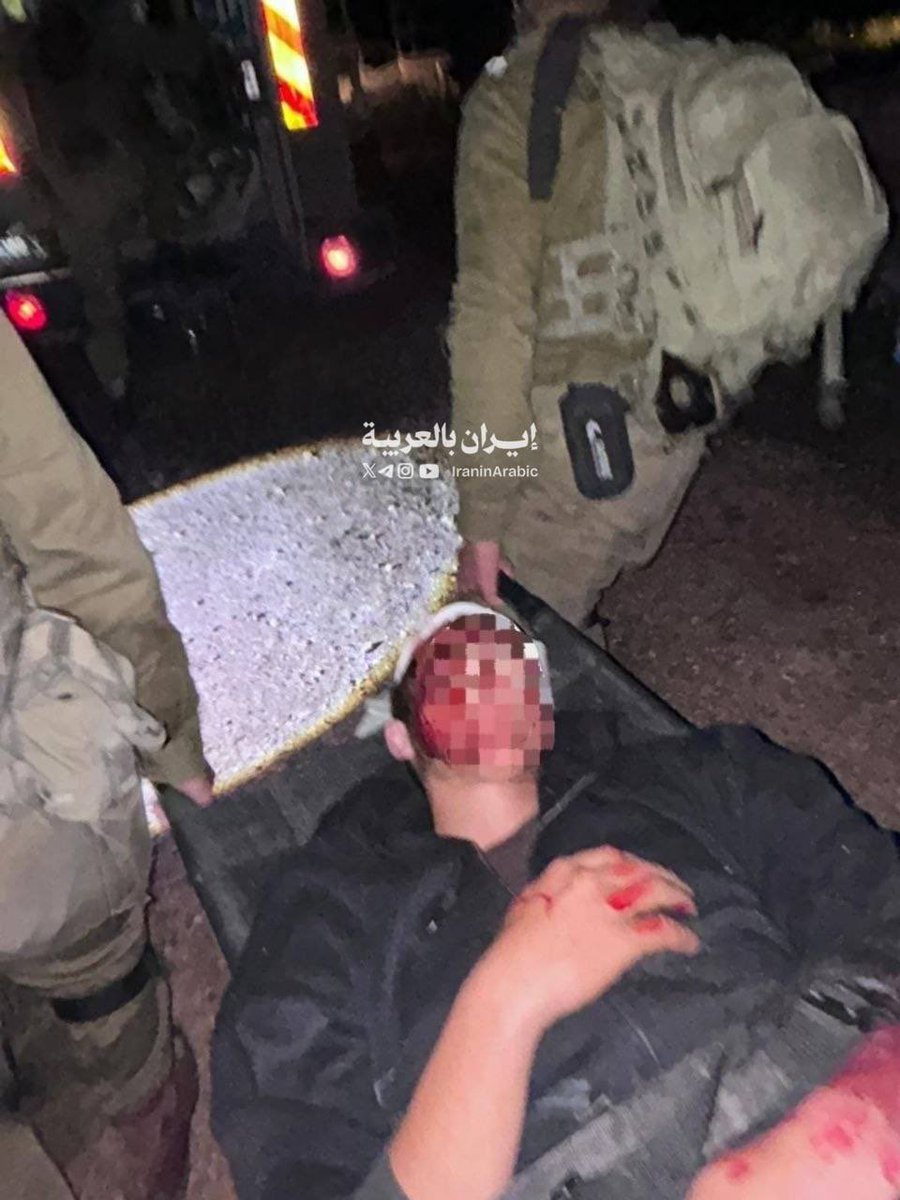 iraninarabic_ir's tweet photo. فلسطين المحتلة: 
إصابة مستوطن بعد تعرضه للضرب من قبل فلسطيني قرب بؤرة استيطانية بمحيط قرية "تياسير" شرق طوباس بالضفة الغربية. https://t.co/wJBU2LZecN