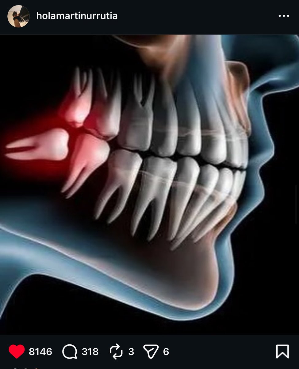 PERDIDA 🐝 tweet media