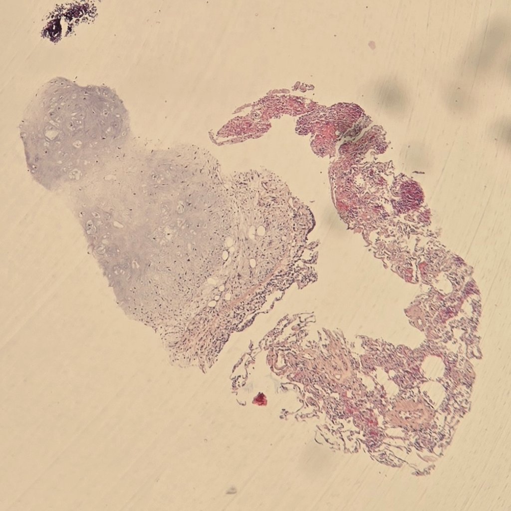 malakbehnas's tweet image. Can you make the diagnosis just from one picture? 

Or is it #toofartodiagnose? 

#pathology #xpath