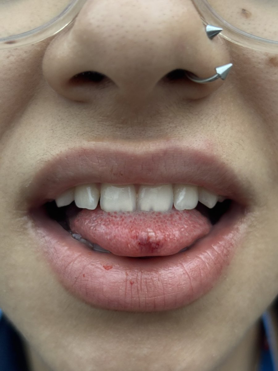 lorax ☀️ #SBR tweet media