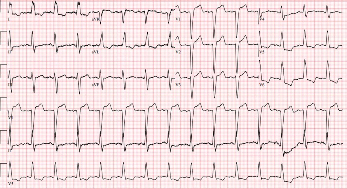 Pierre Elias, MD tweet media