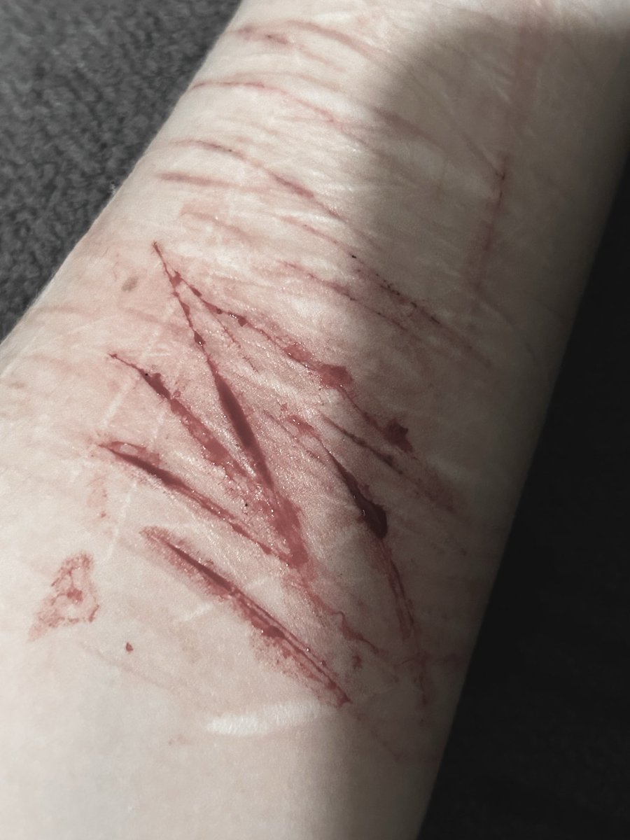 𓂂ᥥ⑅ᥥᣟ⑅݂ sһіkі ᥆𝖿 sһᥱძ𝗍ᥕ𝗍 tweet media