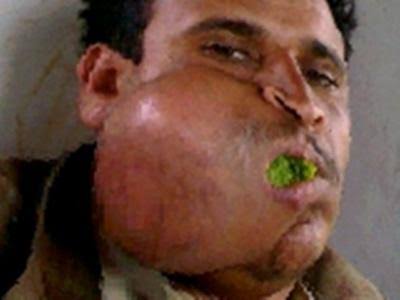 The other®🔴 tweet media