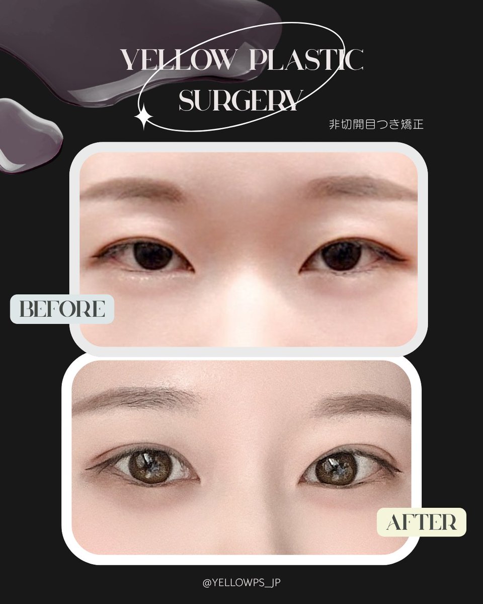 💛イエロー美容整形外科(公式)💛 tweet media