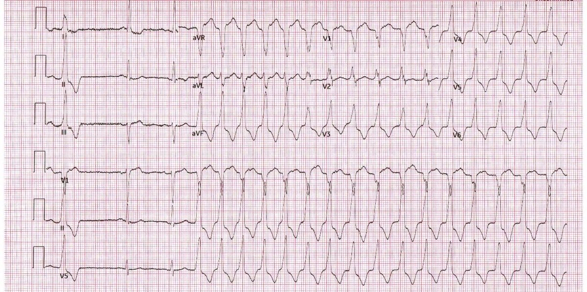 Moiz Ehtesham, MD tweet media