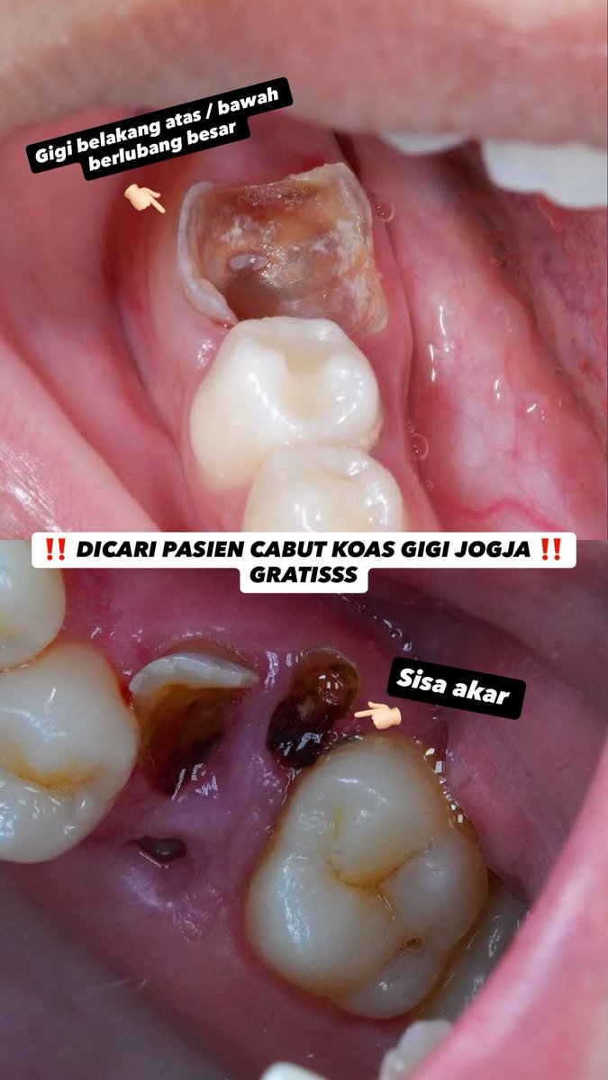 NO DM - KIRIM FESS CEK HIGHLIGHTS tweet media