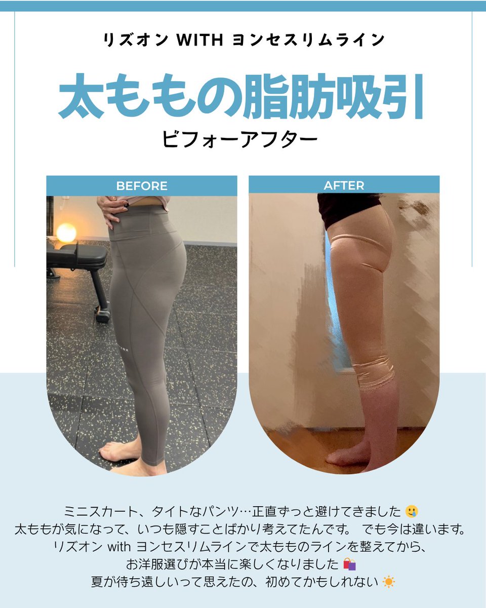 ヨンセスリムライン医院 tweet media