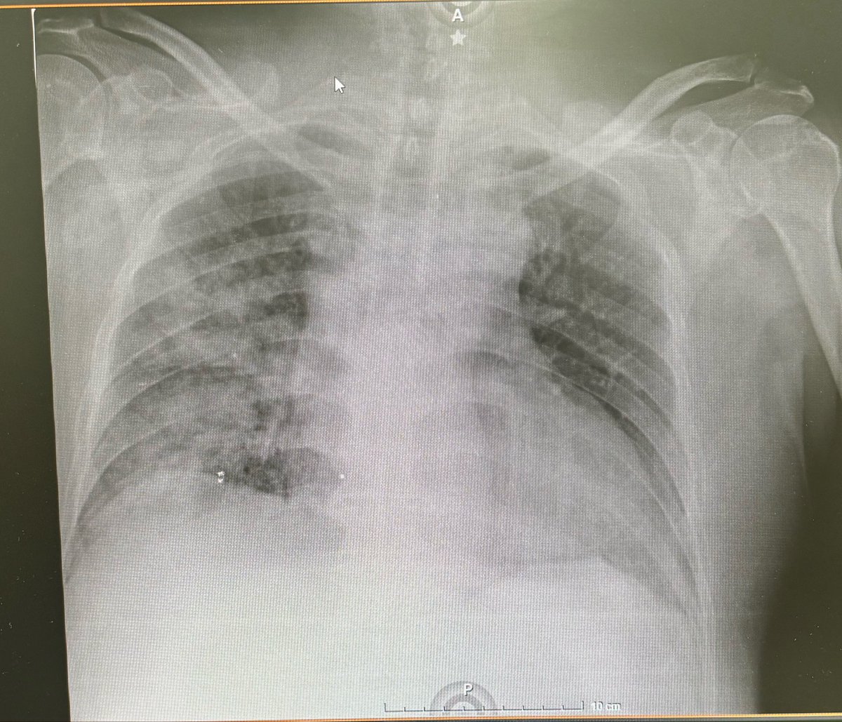 Tony Romero tweet media